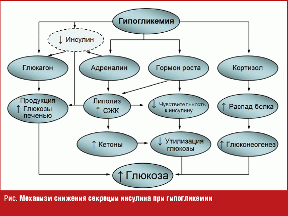 Гипогликемия