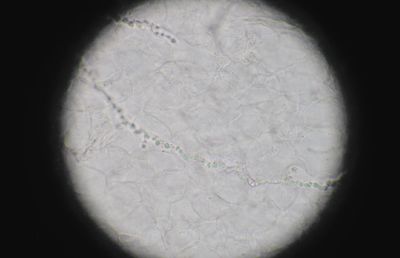 Рис. 3. Артроспоровый мицелий дерматофита