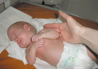 Рис. 2. Ребенку 6 месяцев, масса 2680 граммов