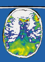 Уже в ближайшем будущем новые технологии начнут помогать нам контролировать свой разум