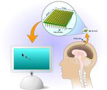 Использование BrainGate