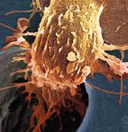 Способы безопасного использования нанотрубок существуют; не следует пренебрегать мерами предосторожности, которые позволят предотвратить вдыхание нанотрубок в местах их производства, использования и утилизации