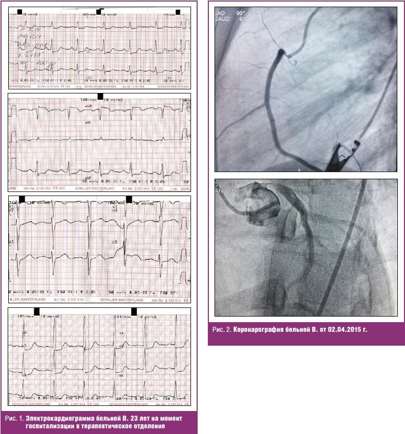 операция на сердце коронарография. операция на сердце коронарография. аппарат для стентирования. коронарография сердца. подготовка к коронарографии сосудов сердца.