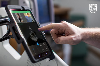 УЗИ с помощью смартфона - оперативная диагностика в критической ситуации и «второе мнение» на расстоянии