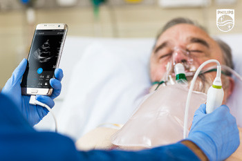 УЗИ с помощью смартфона - оперативная диагностика в критической ситуации и «второе мнение» на расстоянии