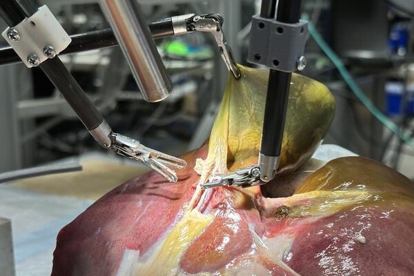 Робот на «движке» ChatGPT провел хирургическую операцию без помощи людей