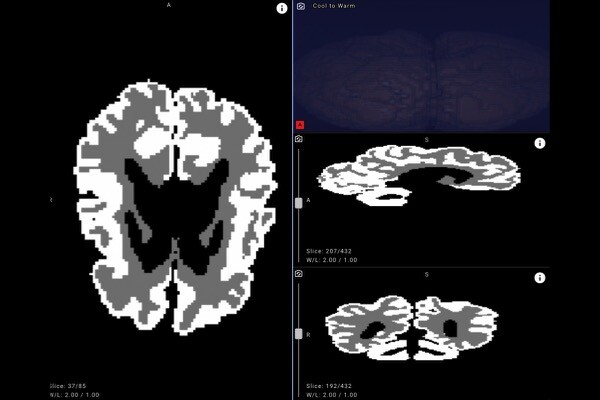 В России создали нейросеть для оценки развития мозга младенцев