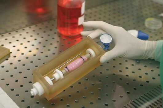 В Швеции произведена первая в мире операция по пересадке искусственной трахеи