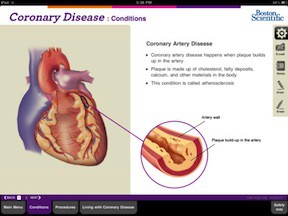 В помощь кардиологу