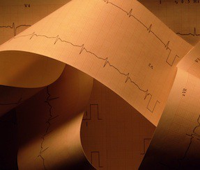 Потребители относятся к персональным электронным медкартам с осторожностью