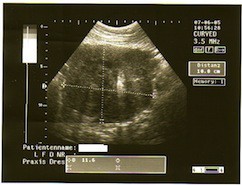 Между молотом и наковальней