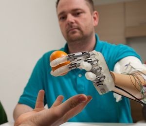 Соединенный с нервной системой протез вернул осязание человеку, потерявшему руку