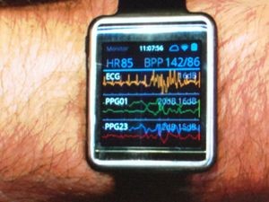 Samsung показала концепт часов Simband