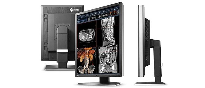 EIZO выпустила новый диагностический монитор