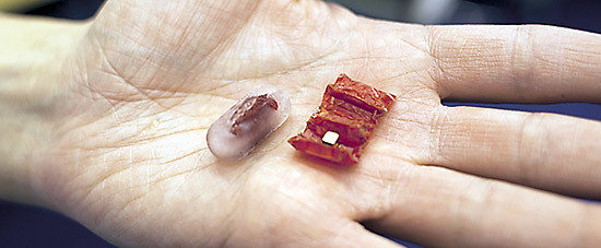 Робот в желудке