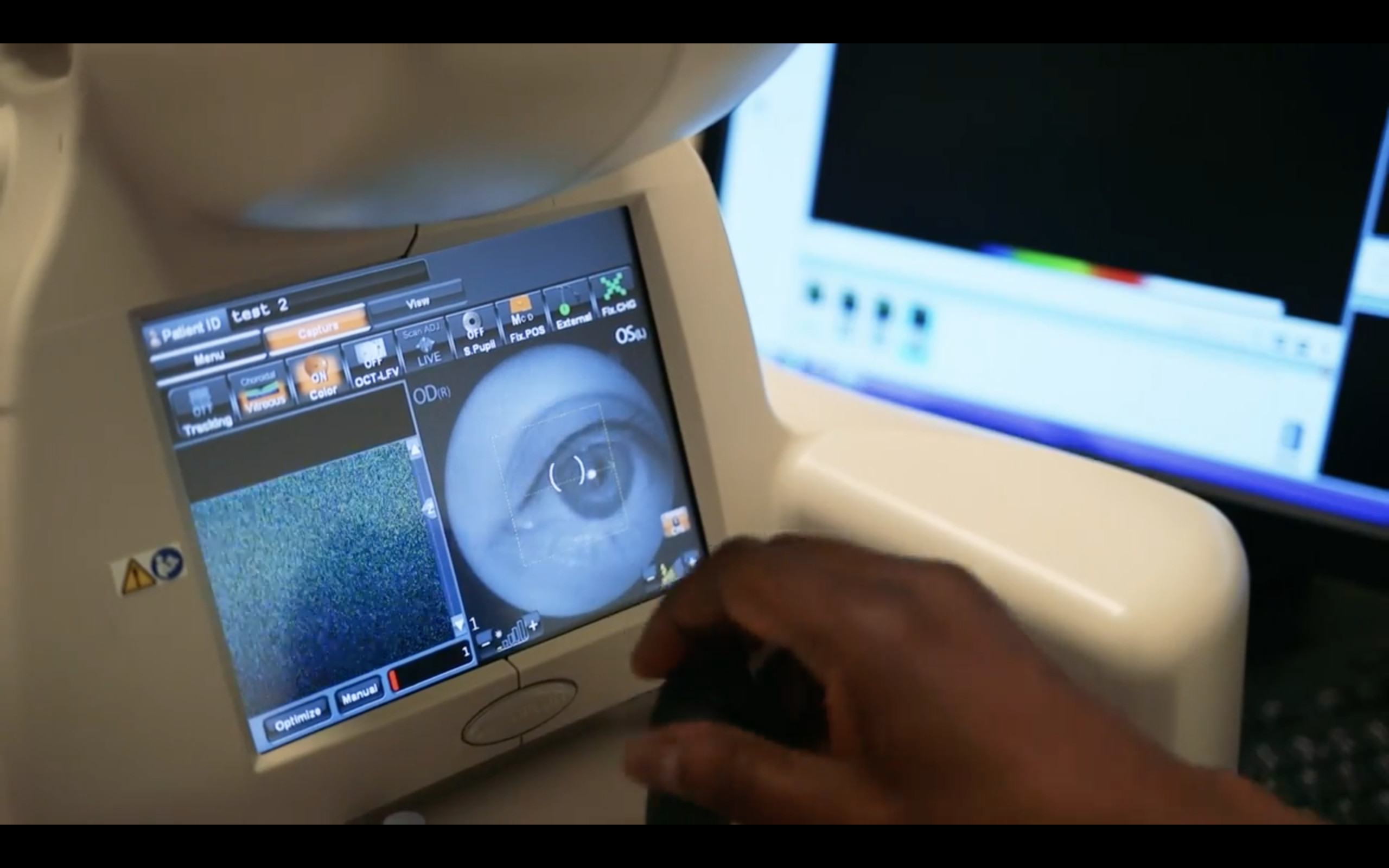 DeepMind научится диагностировать заболевания глаз