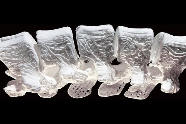 Имплантируемые кости из 