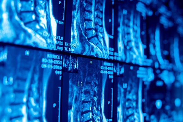 «Ростех» начнет производить «цифровое» лекарство от рака