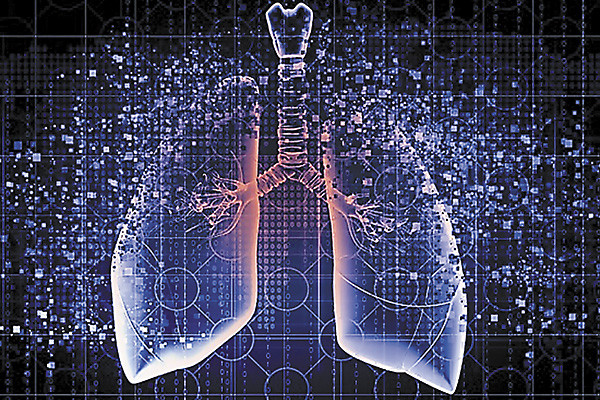 Алгоритмы ищут болезни:  московские радиологи расширяют кругозор искусственного интеллекта
