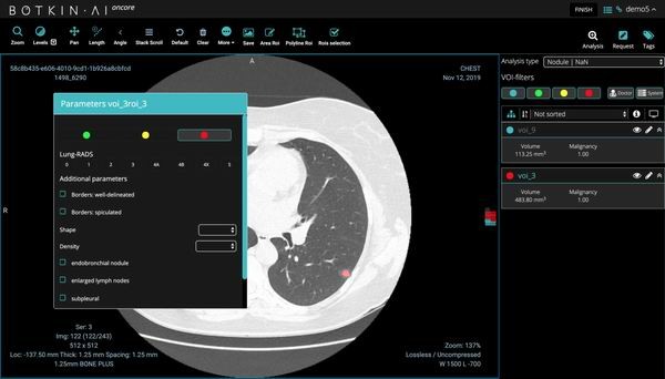 В платформу Botkin.AI добавлен функционал для анализа пневмонии