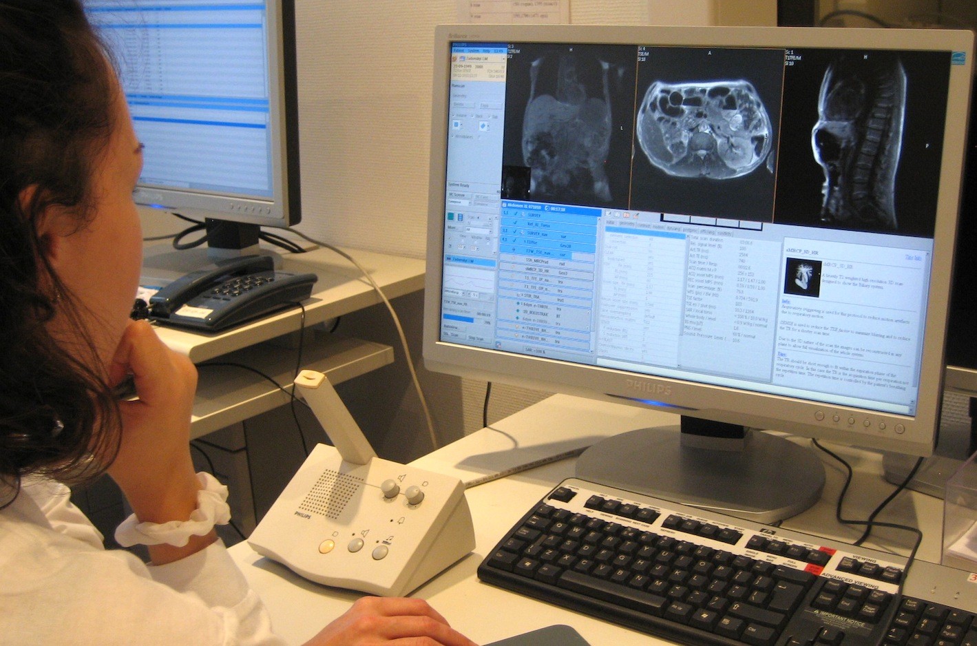 Систему Botkin.AI для скорейшего выявления пневмонии клиникам предлагают бесплатно