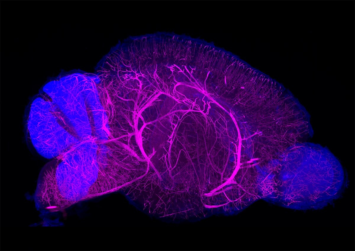 В Японии создали новую технологию визуализации органов и тканей