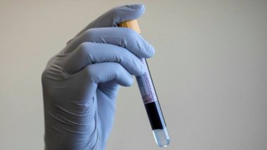 Сервис генетического тестирования заявляет о связи группы крови и Covid-19