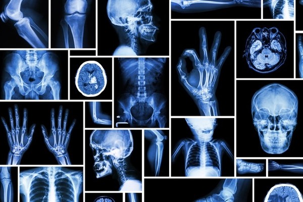 Искусственный интеллект делает опасные ошибки при реконструкции медицинских снимков