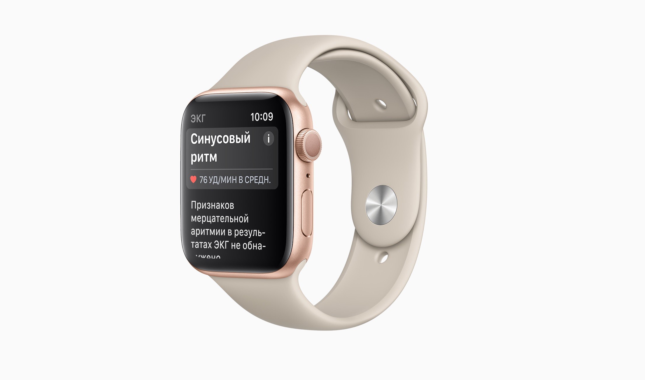 Приложение «ЭКГ» и уведомления о нерегулярном сердечном ритме станут доступны на Apple Watch в России