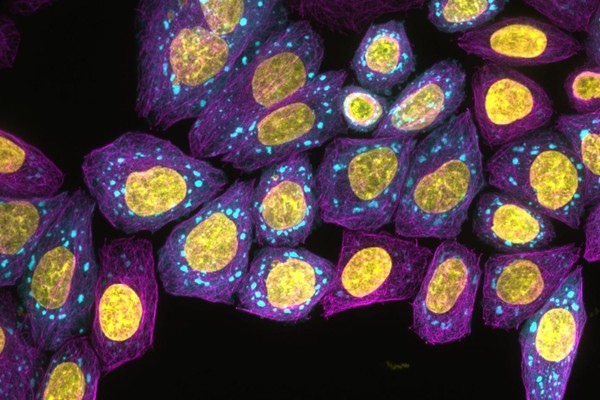 Нейросеть, обученная «биологическому языку» белков, прогнозирует их изменения