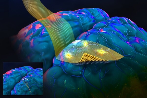 Интерфейс мозг-компьютер с микроиглами возвращает подвижность