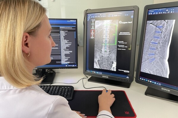 Столичным врачам предложили ИИ-сервис оценки смещения тел позвонков