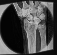 Снимки мягких тканей - МТИ